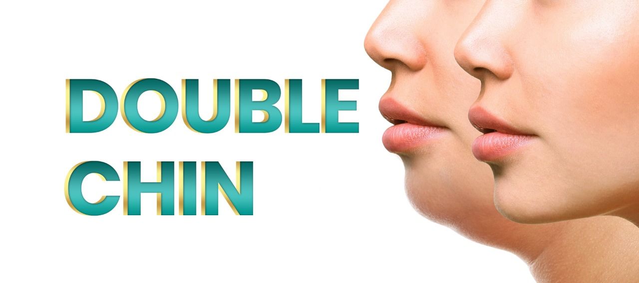Laser Double Chin Treatment - Double Chin Exercise - Get Rid of Double Chin