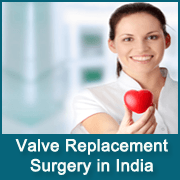 Heart Valve Specialist in India